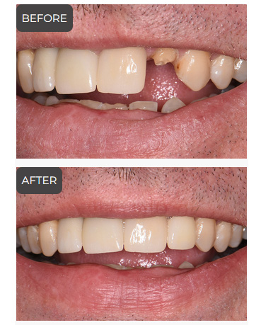 Cosmetic Dentistry in Germantown