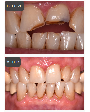 Cosmetic Dentistry in Germantown