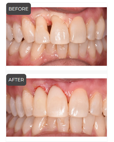 Cosmetic Dentistry in Germantown