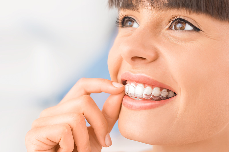 Invisalign in Germantown