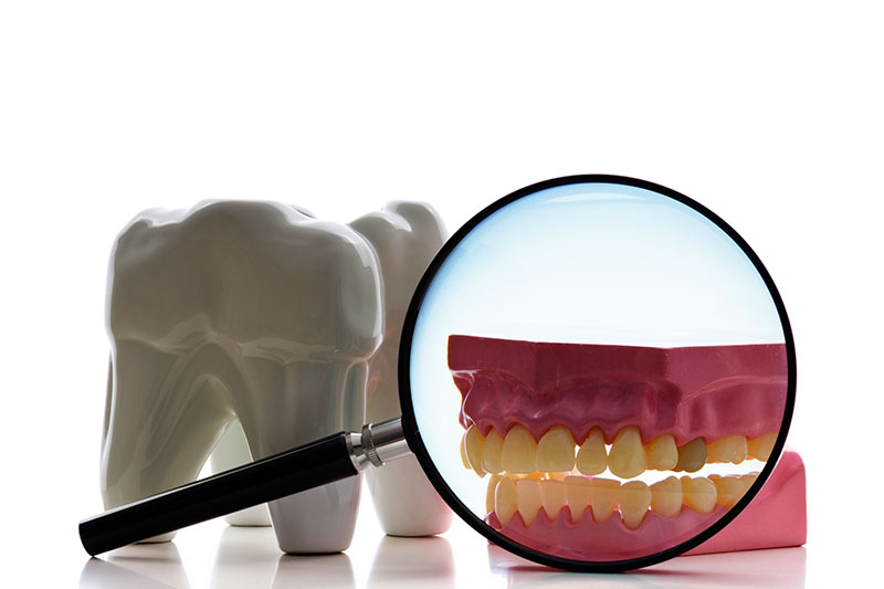 Root Canal in Germantown