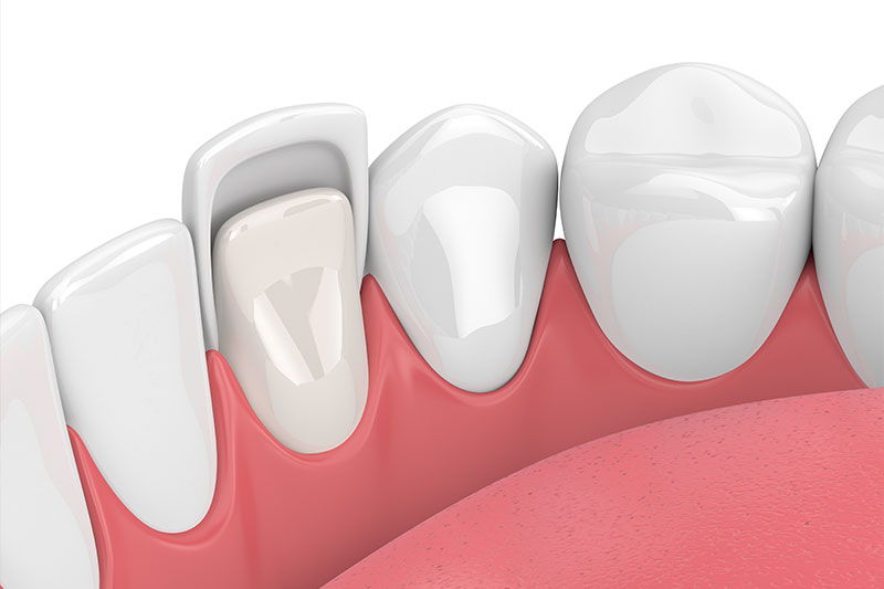 Cosmetic Dentistry in Germantown
